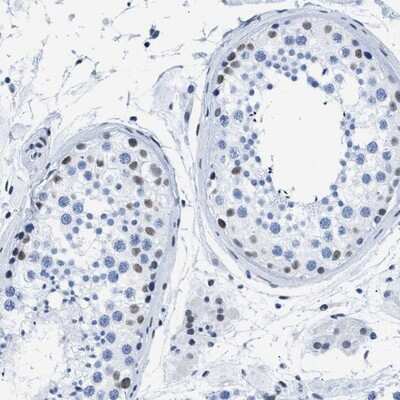 Immunohistochemistry-Paraffin: CtBP1 Antibody [NBP1-88707]