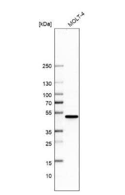 Western Blot: CtBP1 Antibody [NBP1-88707]