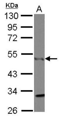 Western Blot: CtBP1 Antibody [NBP2-16023]