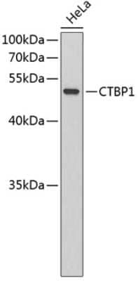 Western Blot: CtBP1 AntibodyAzide and BSA Free [NBP2-92422]