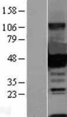 Western Blot: CtBP1 Overexpression Lysate [NBL1-09563]