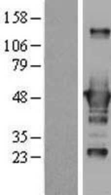 Western Blot: CtBP1 Overexpression Lysate [NBL1-09564]