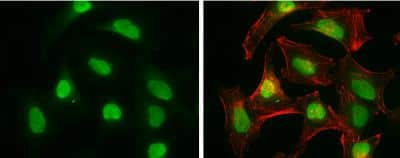 Immunocytochemistry/ Immunofluorescence: CtIP Antibody (19E8) [NBP1-41205]