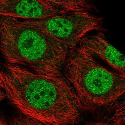 Immunocytochemistry/ Immunofluorescence: CtIP Antibody [NBP2-55651]