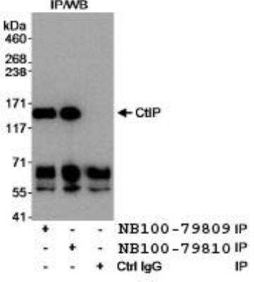 Immunoprecipitation: CtIP Antibody [NB100-79809]