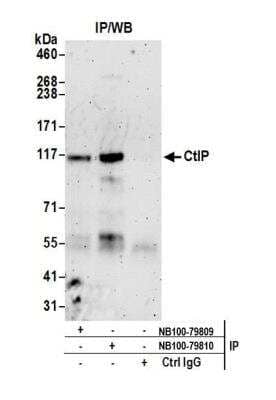 Immunoprecipitation: CtIP Antibody [NB100-79810]