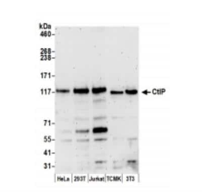 Western Blot: CtIP Antibody [NB100-79810]