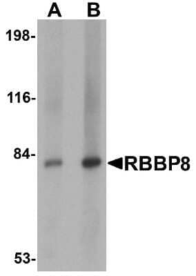 Western Blot: CtIP AntibodyBSA Free [NBP1-77165]