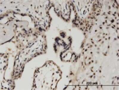 Immunohistochemistry-Paraffin: Ctip1 Antibody (3D9) [H00053335-M03]