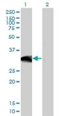 Western Blot: Ctip1 Antibody (3D9) [H00053335-M03]