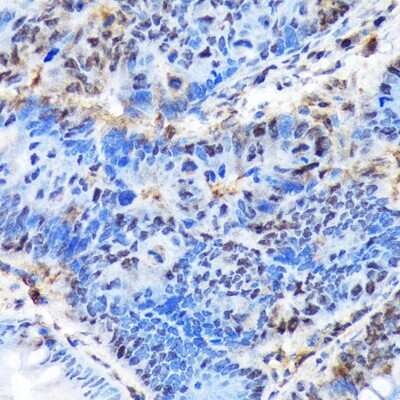 Immunohistochemistry-Paraffin: Ctip1 Antibody (3M8M3) [NBP3-16790]