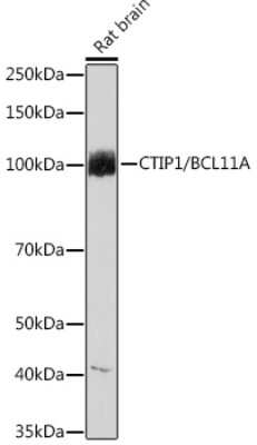 Western Blot: Ctip1 Antibody (3M8M3) [NBP3-16790]