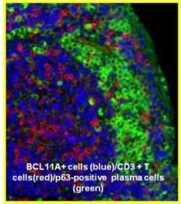 Immunocytochemistry/ Immunofluorescence: Ctip1 Antibody (BCL11A/123) - BSA Free [NBP2-50115]