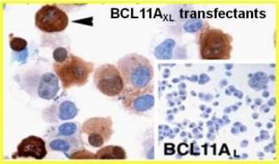 Immunocytochemistry/ Immunofluorescence: Ctip1 Antibody (BCL11A/123) - BSA Free [NBP2-50115]