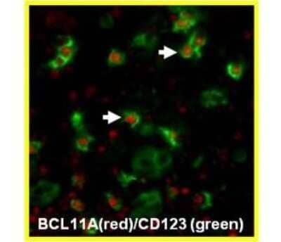 Immunocytochemistry/ Immunofluorescence: Ctip1 Antibody (BCL11A/123) - BSA Free [NBP2-50115]