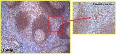 Immunohistochemistry: Ctip1 Antibody (BCL11A/123) - BSA Free [NBP2-50115]