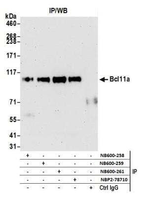 Immunoprecipitation: Ctip1 Antibody (BLR073G) [NBP2-78710]
