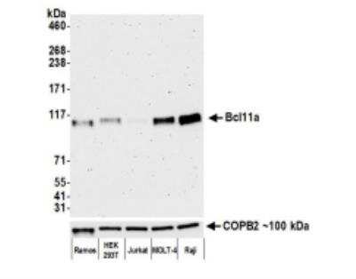 Western Blot: Ctip1 Antibody (BLR073G) [NBP2-78710]
