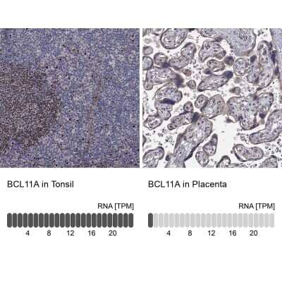 Immunocytochemistry/ Immunofluorescence: Ctip1 Antibody [NBP3-17030]