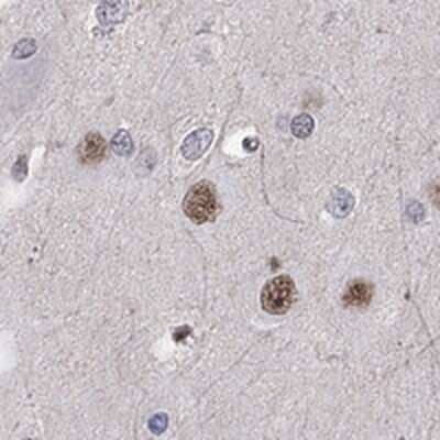 Immunohistochemistry-Paraffin: Ctip1 Antibody [NBP3-17030]