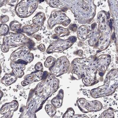 Immunohistochemistry-Paraffin: Ctip1 Antibody [NBP3-17030]