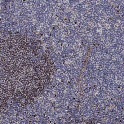 Immunohistochemistry-Paraffin: Ctip1 Antibody [NBP3-17030]