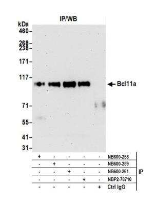 Immunoprecipitation: Ctip1 Antibody [NB600-258]