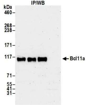 Immunoprecipitation: Ctip1 Antibody (BLR151J) [NBP3-14729]