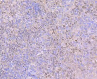 Immunohistochemistry-Paraffin: Ctip1 Antibody (JB35-68) [NBP2-75455]