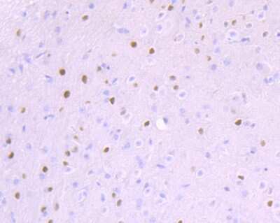 Immunohistochemistry-Paraffin: Ctip1 Antibody (JB35-68) [NBP2-75455]