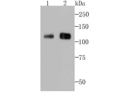 Western Blot: Ctip1 Antibody (JB35-68) [NBP2-75455]