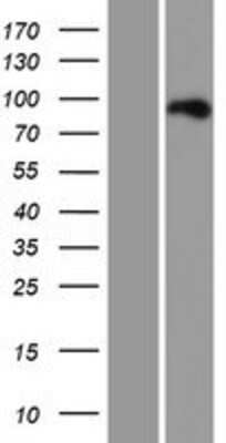 Western Blot: Ctip1 Overexpression Lysate [NBP2-06379]