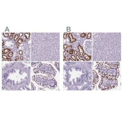 Immunohistochemistry-Paraffin: Cubilin Antibody [NBP2-62596]