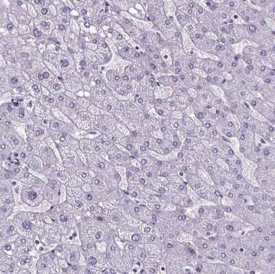 Immunohistochemistry-Paraffin: Cubilin Antibody [NBP2-62596]