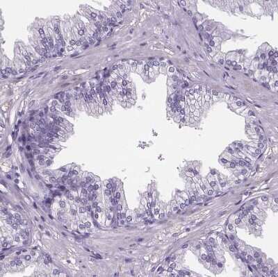 Immunohistochemistry-Paraffin: Cubilin Antibody [NBP2-62596]