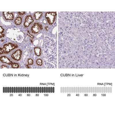 Immunohistochemistry-Paraffin: Cubilin Antibody [NBP2-62596]