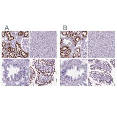 Immunohistochemistry-Paraffin: Cubilin Antibody [NBP2-62611]