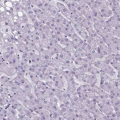 Immunohistochemistry-Paraffin: Cubilin Antibody [NBP2-62611]