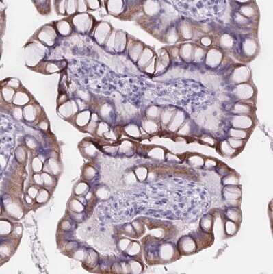 Immunohistochemistry-Paraffin: Cubilin Antibody [NBP2-62611]