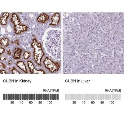 Immunohistochemistry-Paraffin: Cubilin Antibody [NBP2-62611]