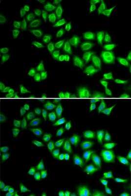 Immunocytochemistry/ Immunofluorescence: Cullin 1 Antibody - Azide and BSA Free [NBP3-16092]