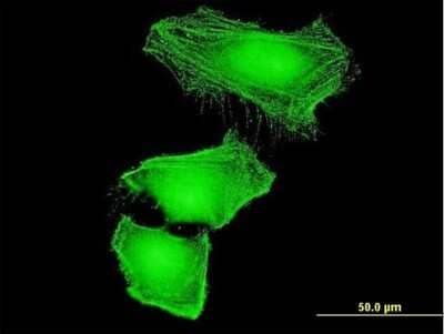 Immunocytochemistry/ Immunofluorescence: Cullin 2 Antibody (4G11) [H00008453-M03]