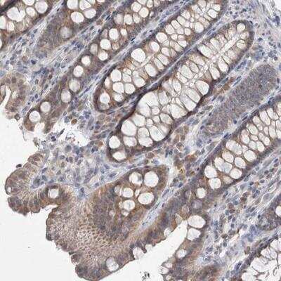 Immunohistochemistry: Cullin 2 Antibody [NBP1-87544]