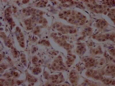 Immunohistochemistry: Cullin 3 Antibody (7B6) [NBP3-15168]