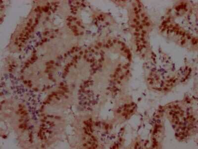 Immunohistochemistry: Cullin 3 Antibody (7B6) [NBP3-15168]