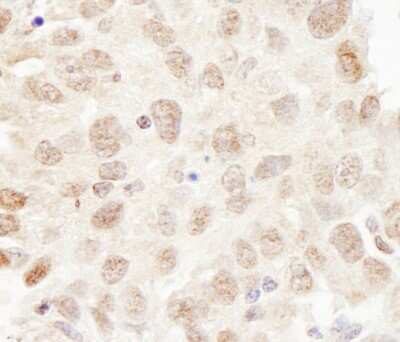 Immunohistochemistry-Paraffin: Cullin 3 Antibody [NB100-58788]