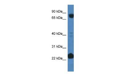 Western Blot: Cullin 3 Antibody [NBP2-88798]