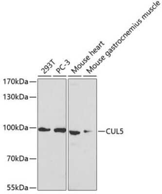 Western Blot: Cullin 5 AntibodyBSA Free [NBP2-92652]