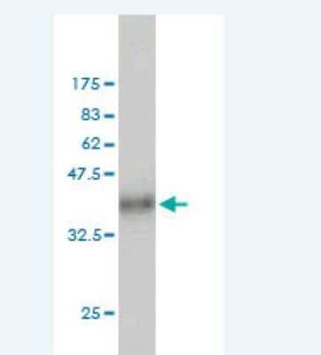 Western Blot: Cullin-7 Antibody (2G11) [H00009820-M01]