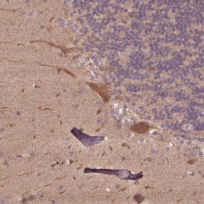 Immunohistochemistry-Paraffin: CutA Antibody [NBP2-39025]